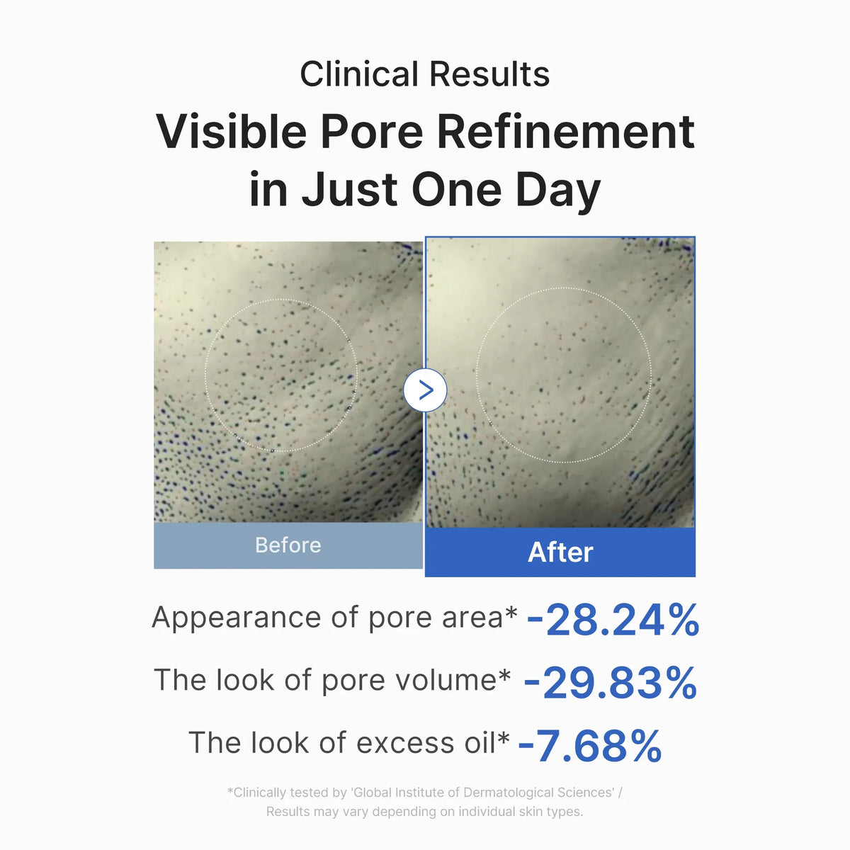 [Subscr.] Zero Pore One-day Peptide Serum
