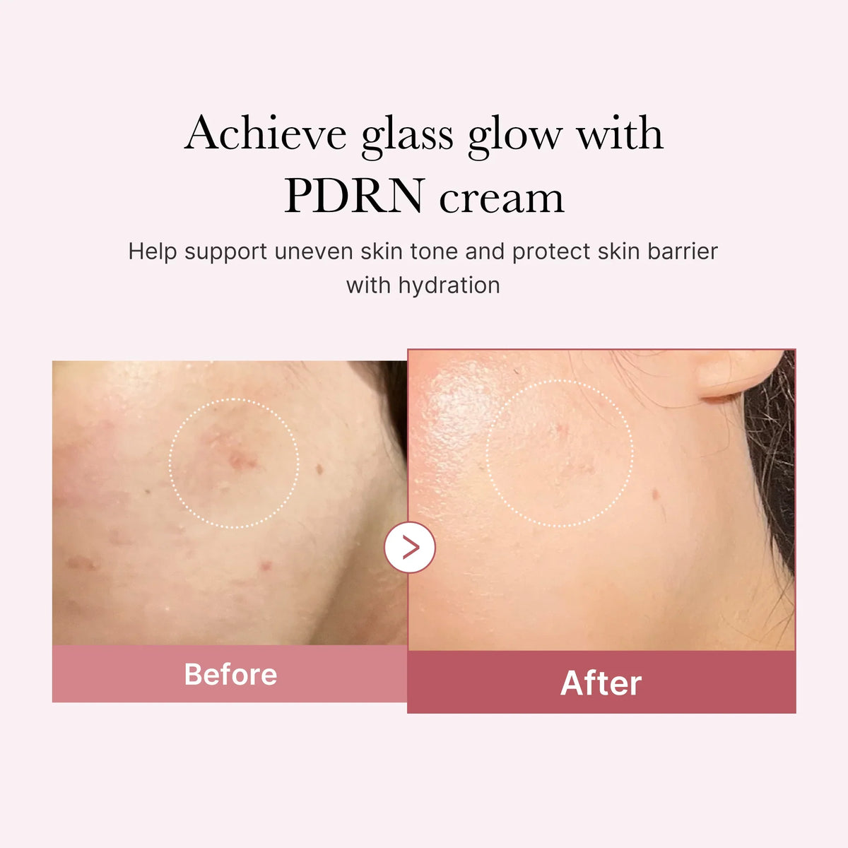 [Subscr.] PDRN Pink Peptide Cream