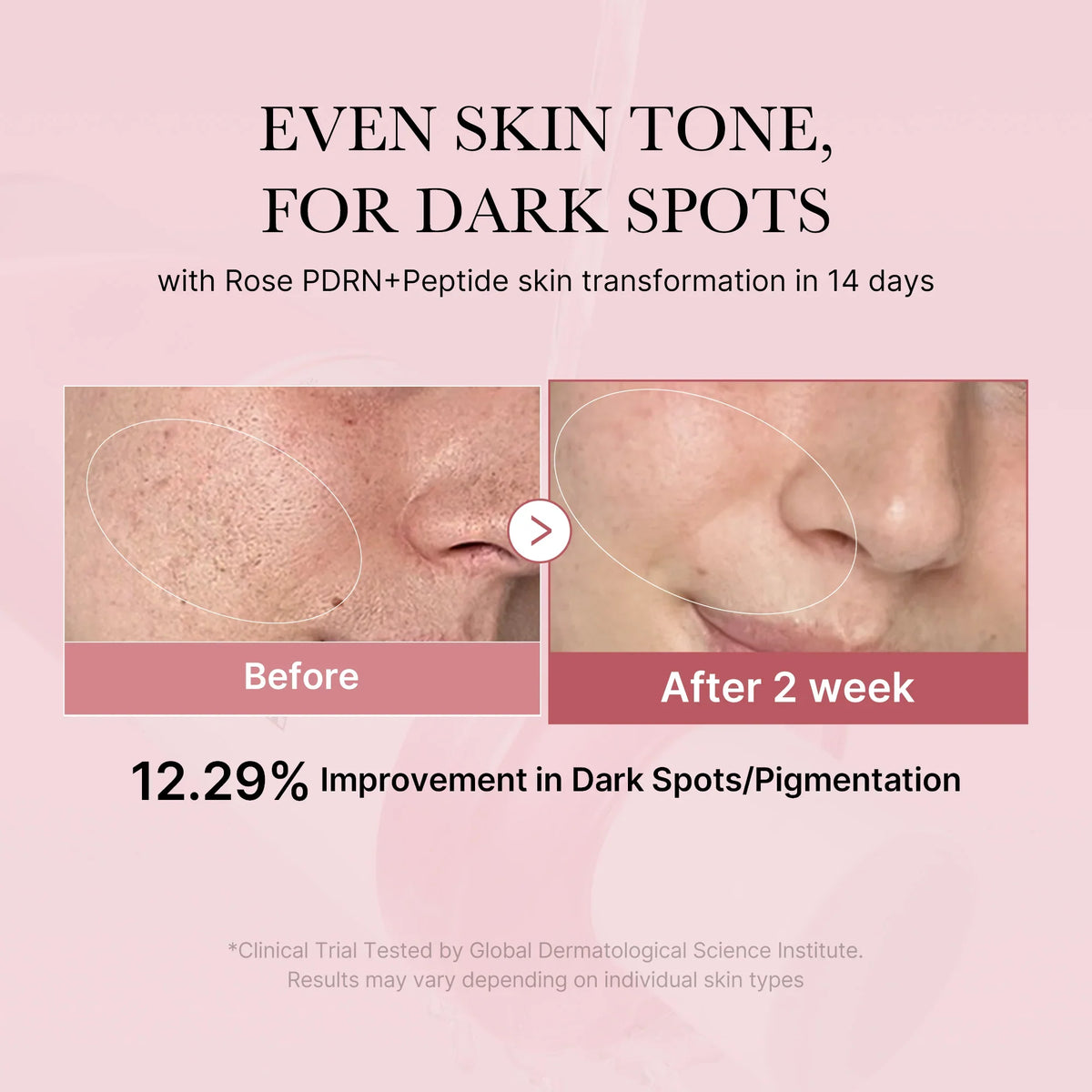 [GIFT] PDRN Pink Peptide Toner