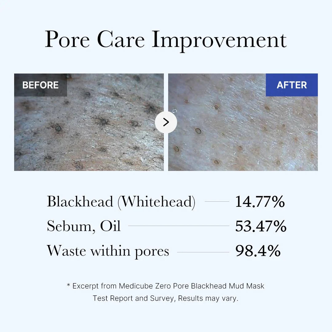 [Subscr.] Zero Pore Blackhead Mud Mask