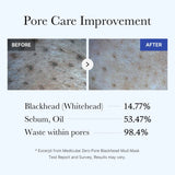 [Subscr.] Zero Pore Blackhead Mud Mask