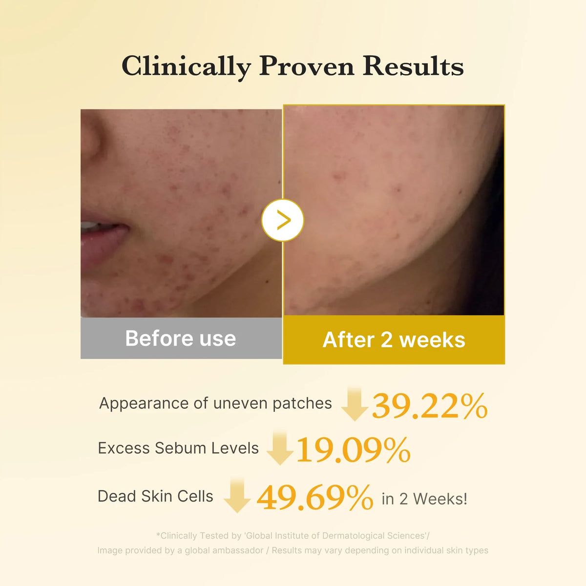 [Subscr.] Kojic Acid Turmeric Toner Pad