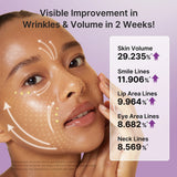 7-Day Anti-Aging & Plump Set