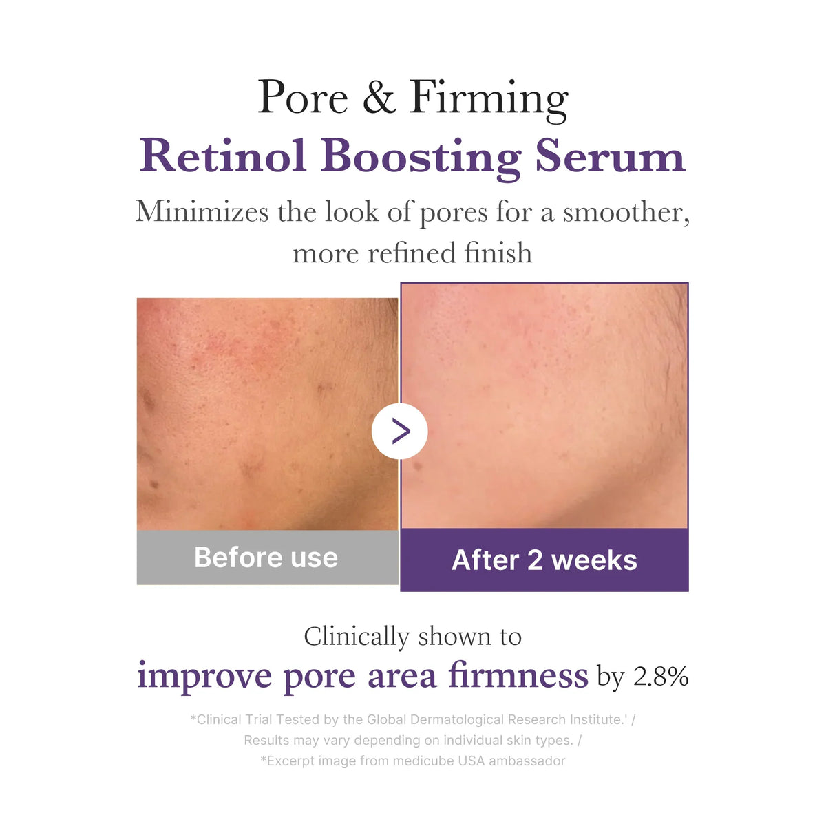 [GIFT] Retinol NMN Boosting Serum