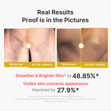 Kojic Acid Turmeric Body Peel Shot